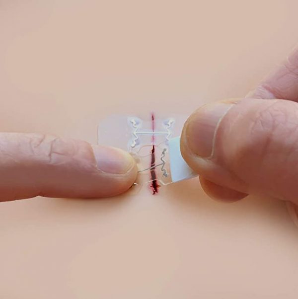 Micromend Emergency Wound Closures